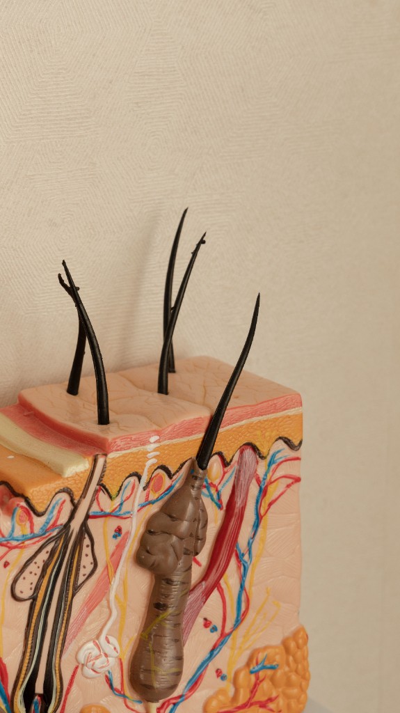 Anatomical model showing skin layers and hair follicles for PRP scalp treatment