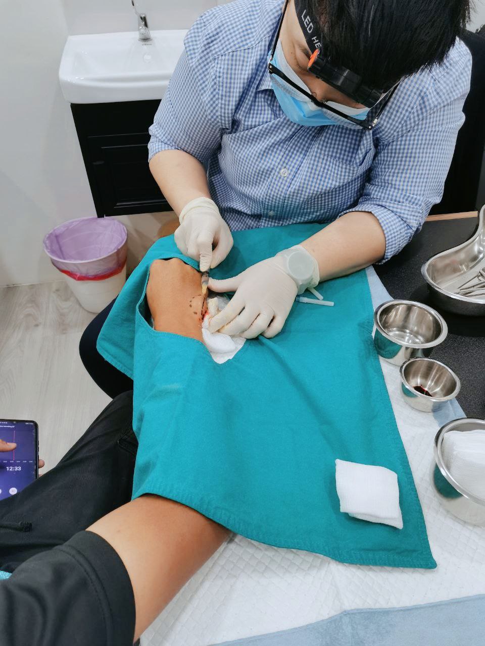 Minor surgical excision procedure performed under sterile conditions at the clinic