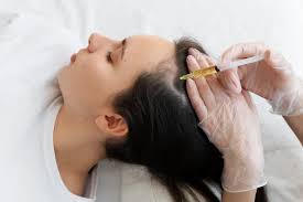 PRP scalp treatment for hair loss at Klinik Tong & Surgeri